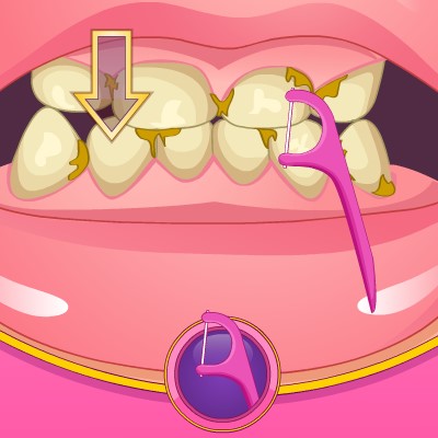 Гра Відновлення Зубів для Дівчинки